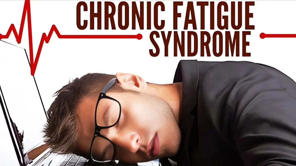 Million Americans Affected by Chronic Fatigue Syndrome